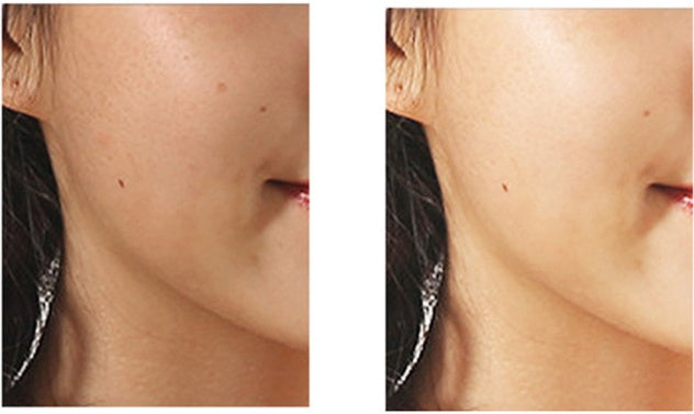 Mini-Gesichtsreinigungsbürste mit rotierender Porenreinigung