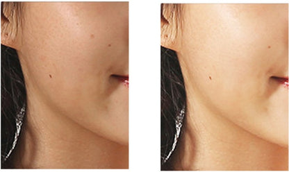 Mini-Gesichtsreinigungsbürste mit rotierender Porenreinigung