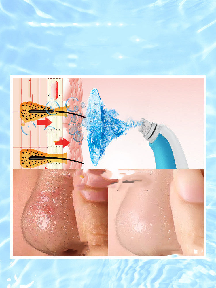 Heim-Gesichtsreiniger – Small-Bubble-Porenreiniger, Beauty-Gerät