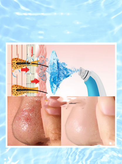 Heim-Gesichtsreiniger – Small-Bubble-Porenreiniger, Beauty-Gerät
